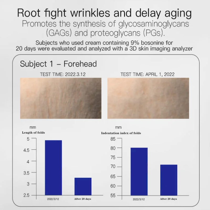 Clinically Proven Face Cream Wrinkle Reduction Results