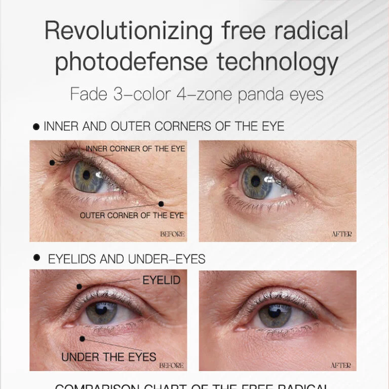 Eye care